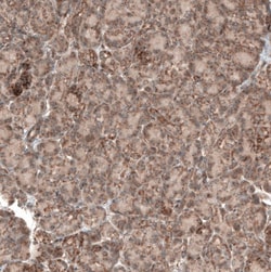 PER3 Antibody, Novus Biologicals 25 μL; Unlabeled:Antibodies, Polyclonal